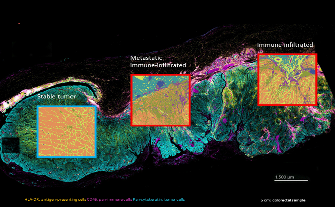 Hyperion XTi Imaging System 이미지01